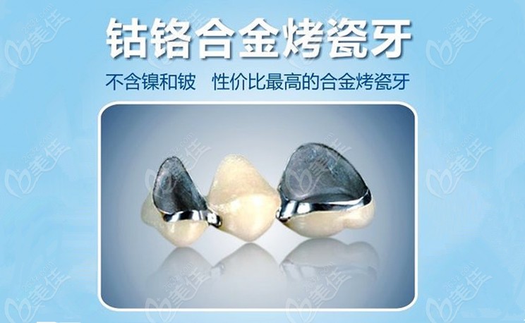 贵金属烤瓷牙价格(贵金属烤瓷牙和全瓷牙价格)